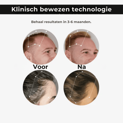 RejuvaCap™ Rood Licht Therapie Cap
